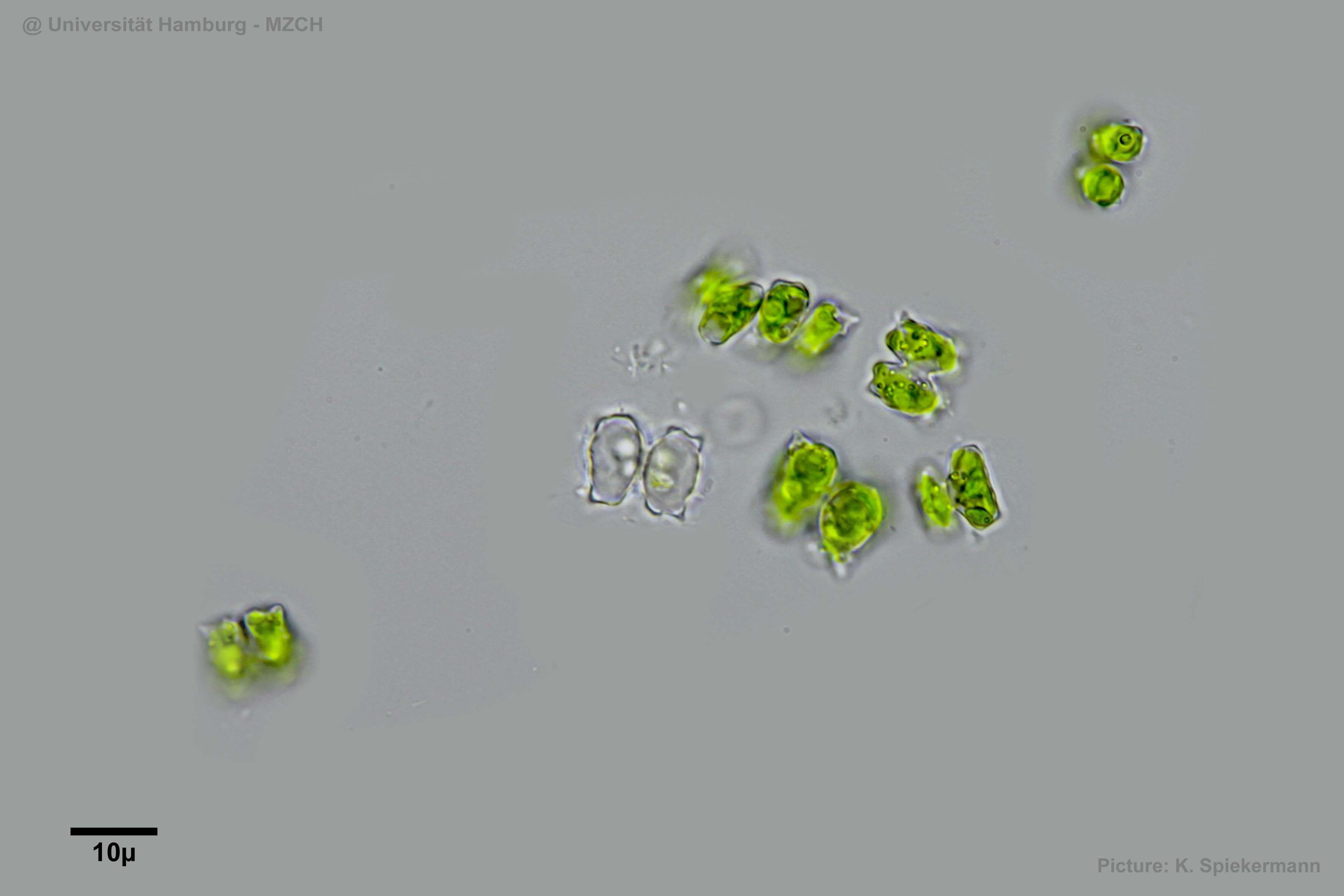 463_Cosmarium dilatatum_Hülle_WH